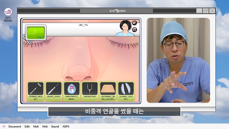 매부리코 코수술 게임 후기 및 비중격연골 매부리 코수술 방법 코수술 진행 과정 압구정서울성형외과 관련 이미지 21