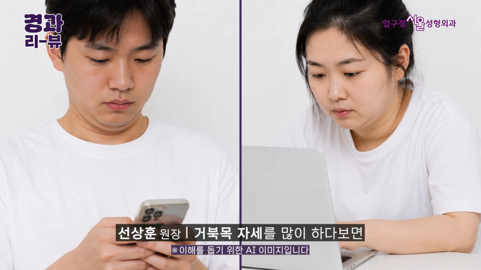 안면거상 전후 후기 압구정서울성형외과 실제 케이스 비교 분석 관련 이미지 4