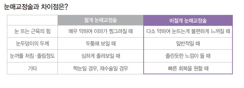 [Apgujeong Seoul Plastic Surgery] Non-incisional Eye Correction for Clearer, More Defined Eyes image 4