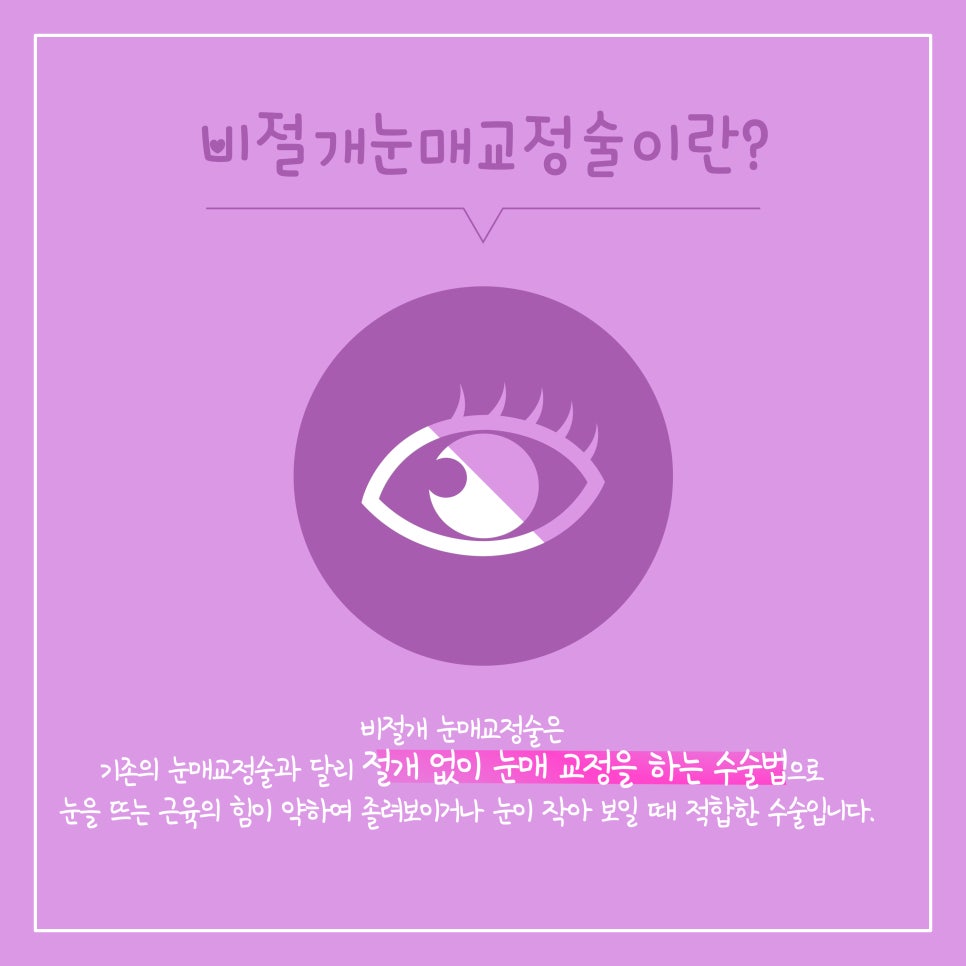흉터 없이 크고 시원한 눈매를 만드는 비절개 눈매교정 관련 이미지 2
