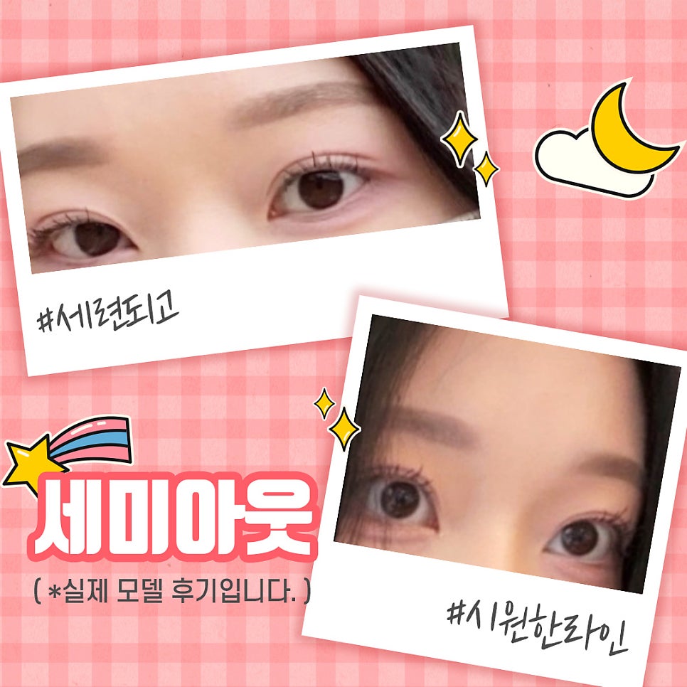[Apgujeong Best Double Eyelid Clinic] What Is the Difference Between an In-Out and a Semi-Out Double Eyelid Line? image 6