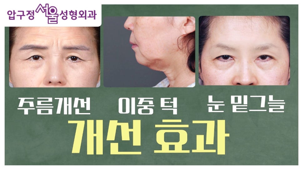 다양한 피부고민 개선, 아그네스레이저란? (리얼 지방 제거영상 有) 관련 이미지 5