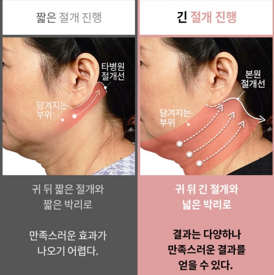 나이테같은 목주름을 확실히 당겨주는 방법은? "목거상술" 관련 이미지 3