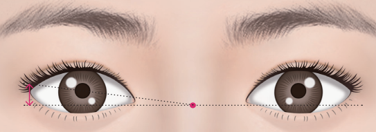 [Apgujeong Seoul Plastic Surgery] Ideal Eye Shape? image 5