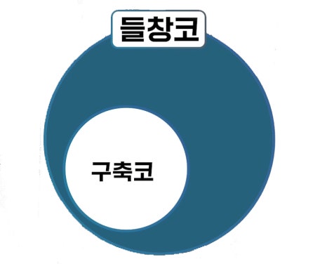들창코 구축코 짧은코 원인, 차이 코수술재료, 코성형 압구정서울성형외과 관련 이미지 6
