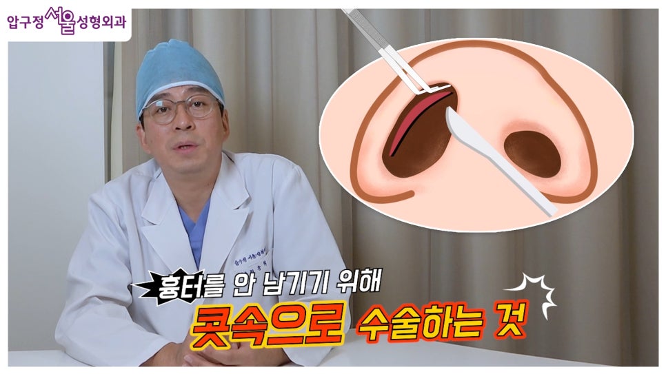 개방형 비개방형 코수술 차이점 장단점까지 한눈에 정리 관련 이미지 2