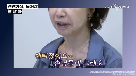 Before-and-After of Facelift and Neck Lift Surgery in Apgujeong: SMAS Facelift Case at Apgujeong Seoul Plastic Surgery image 8