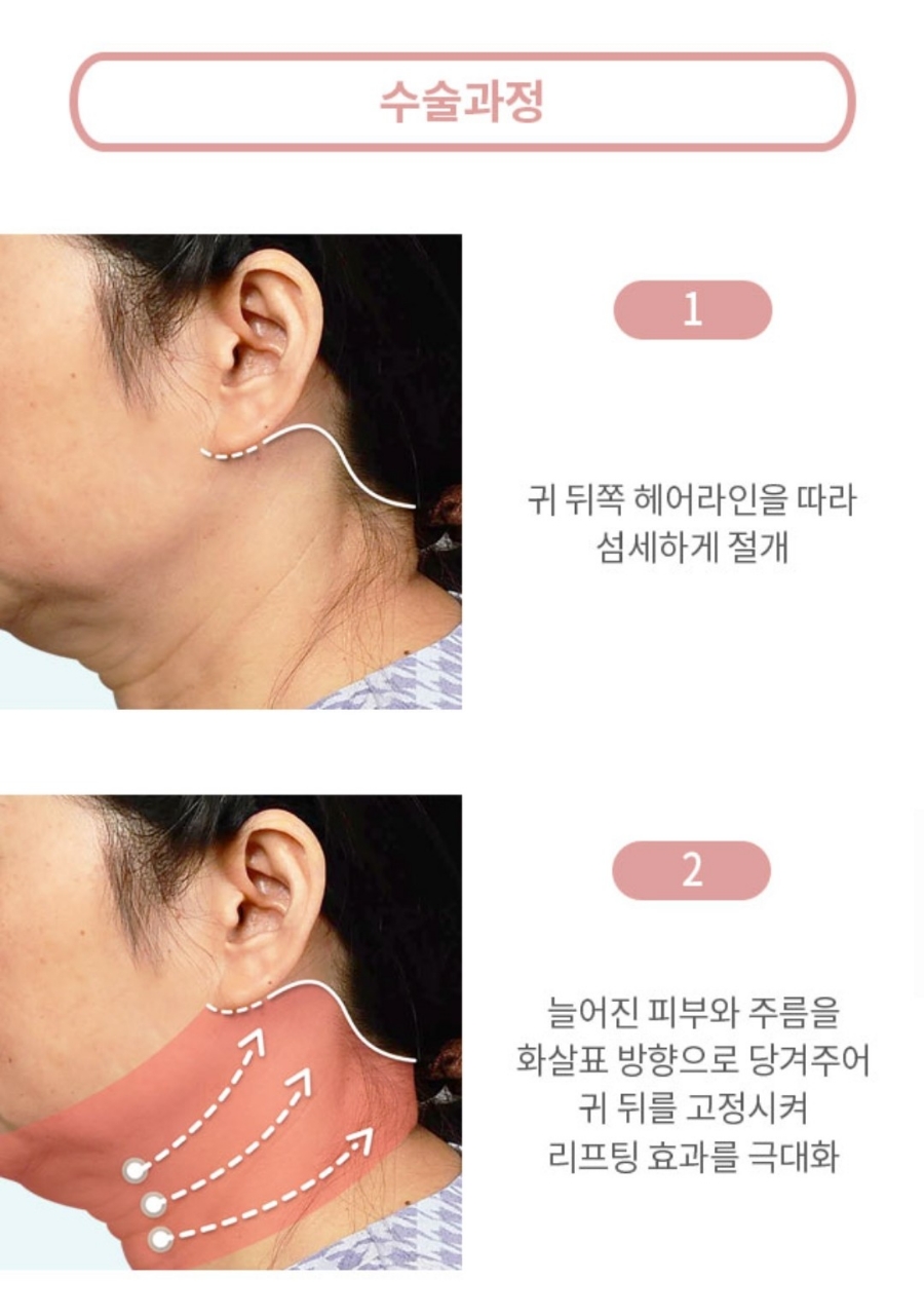 나이테같은 목주름을 확실히 당겨주는 방법은? "목거상술" 관련 이미지 6
