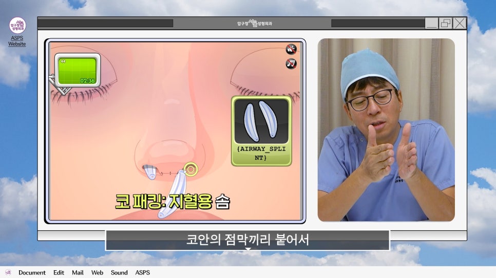 매부리코 코수술 게임 후기 및 비중격연골 매부리 코수술 방법 코수술 진행 과정 압구정서울성형외과 관련 이미지 22