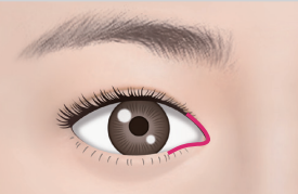 [Apgujeong Seoul Plastic Surgery] Ideal Eye Shape? image 4
