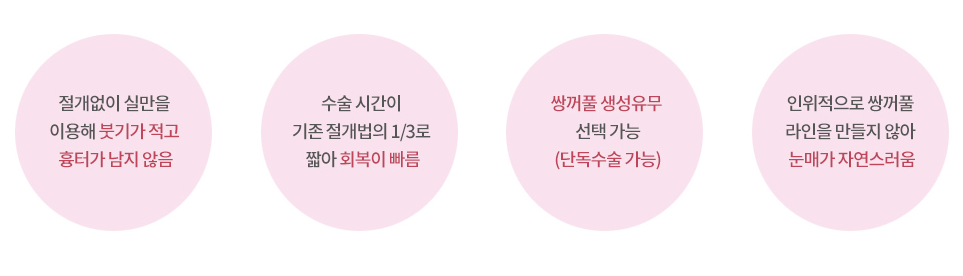 눈매교정과 쌍수 똑같은 줄 아셨나요? 관련 이미지 4