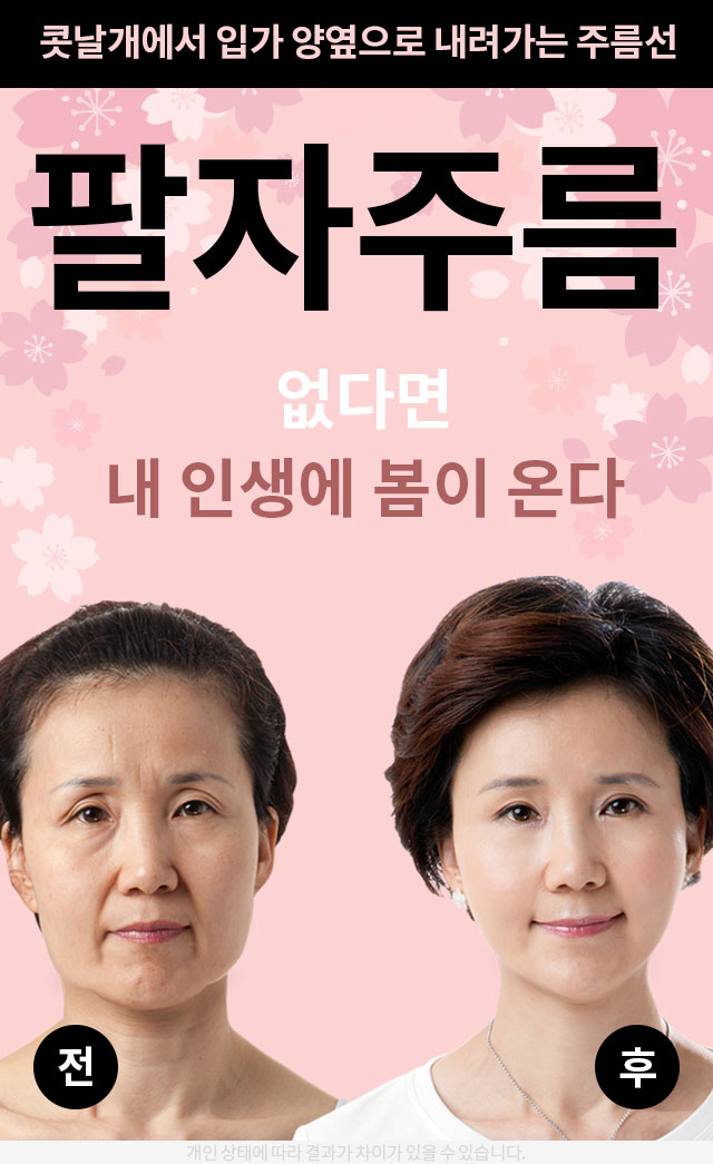 "SMAS Facelift" to Firmly Restore Sagging Jowls and Nasolabial Folds image 2
