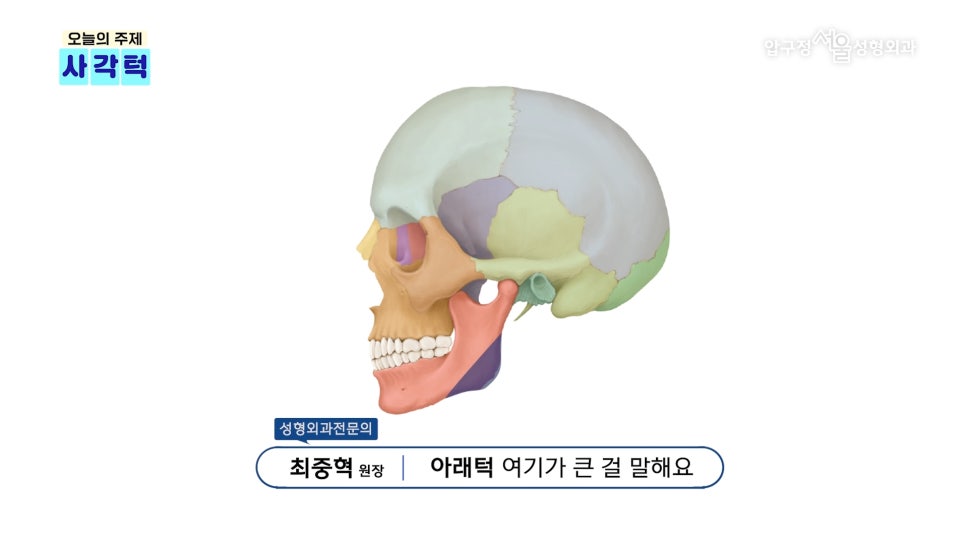 압구정 안면윤곽 사각턱, 광대, 턱끝 개념과 종류 수술방법 압구정서울성형외과 관련 이미지 6