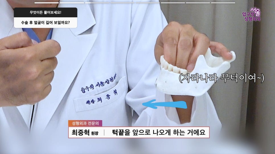 서울 압구정서울 무턱보형물 침식 재수술 무턱 수술 궁금증과 후기 관련 이미지 6