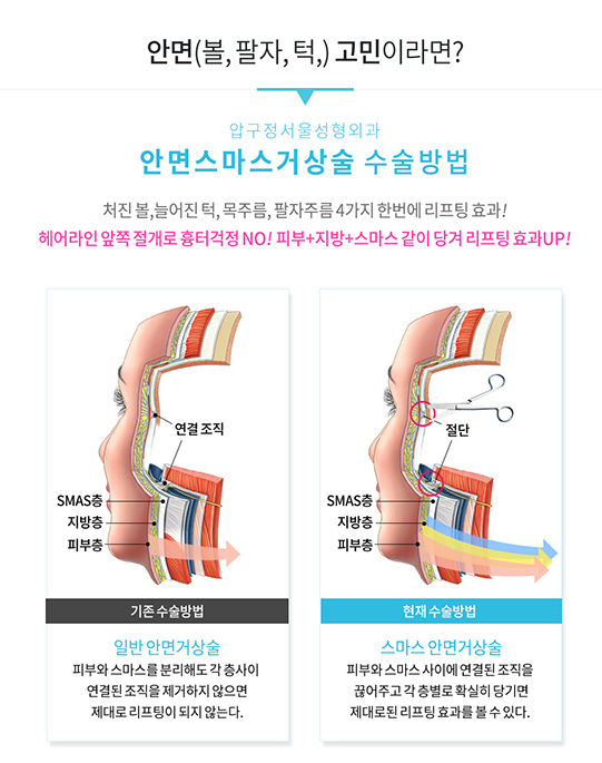 Before-and-After of Facelift and Neck Lift Surgery in Apgujeong: SMAS Facelift Case at Apgujeong Seoul Plastic Surgery image 4