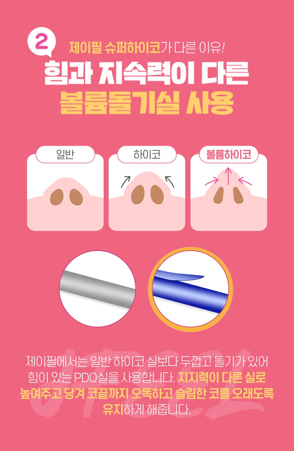 4월추천시술! 슈퍼 하이코, 코필러로 쉽고 간단하게 예뻐지는법 관련 이미지 3