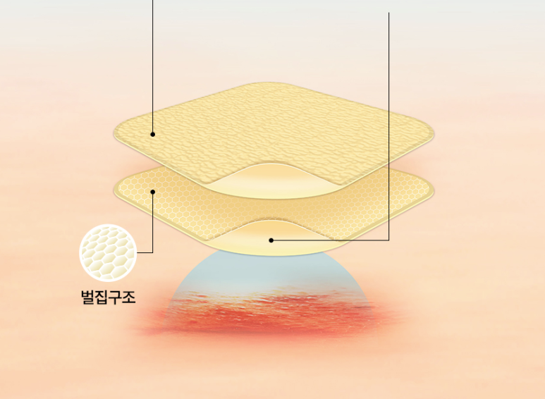 Post-Removal Care for Moles, Thread Lifting, and Fillers | Proper Use of DuoDerm image 4