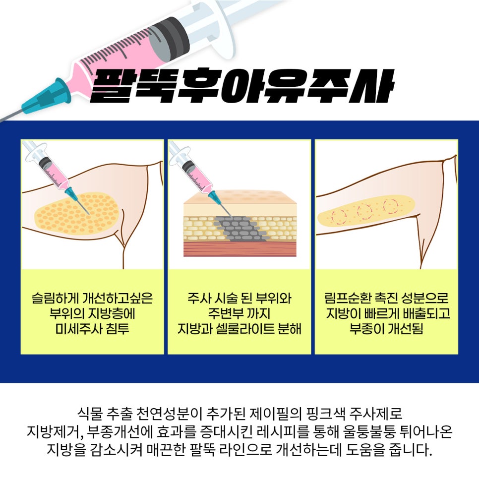 팔뚝지방분해 후아유와 울핏으로 팔뚝살 해결 관련 이미지 5