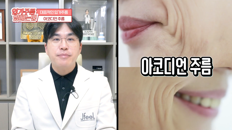 입가주름시술, 원인부터 치료, 예방까지 한 번에 관련 이미지 2