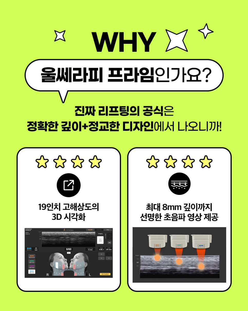 Jeiyeon Ulthera 600 Shots, Curious About How Long the Pain Lasts After Ulthera? image 9