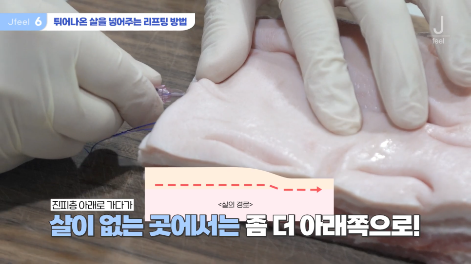 민트실을 돼지고기에 넣는다면? 실리프팅 실험 관련 이미지 18