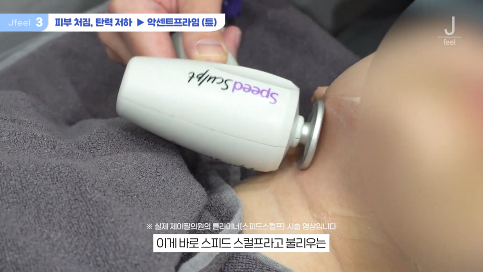 3O대피부과시술 3가지 추천 관련 이미지 10