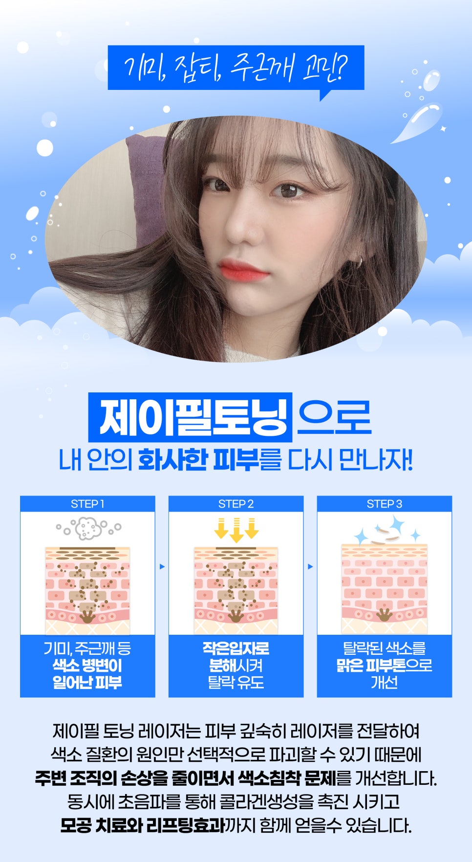 피부토닝과 쿨링관리를 동시에! 제이필 ICE쿨링토닝으로 관련 이미지 3