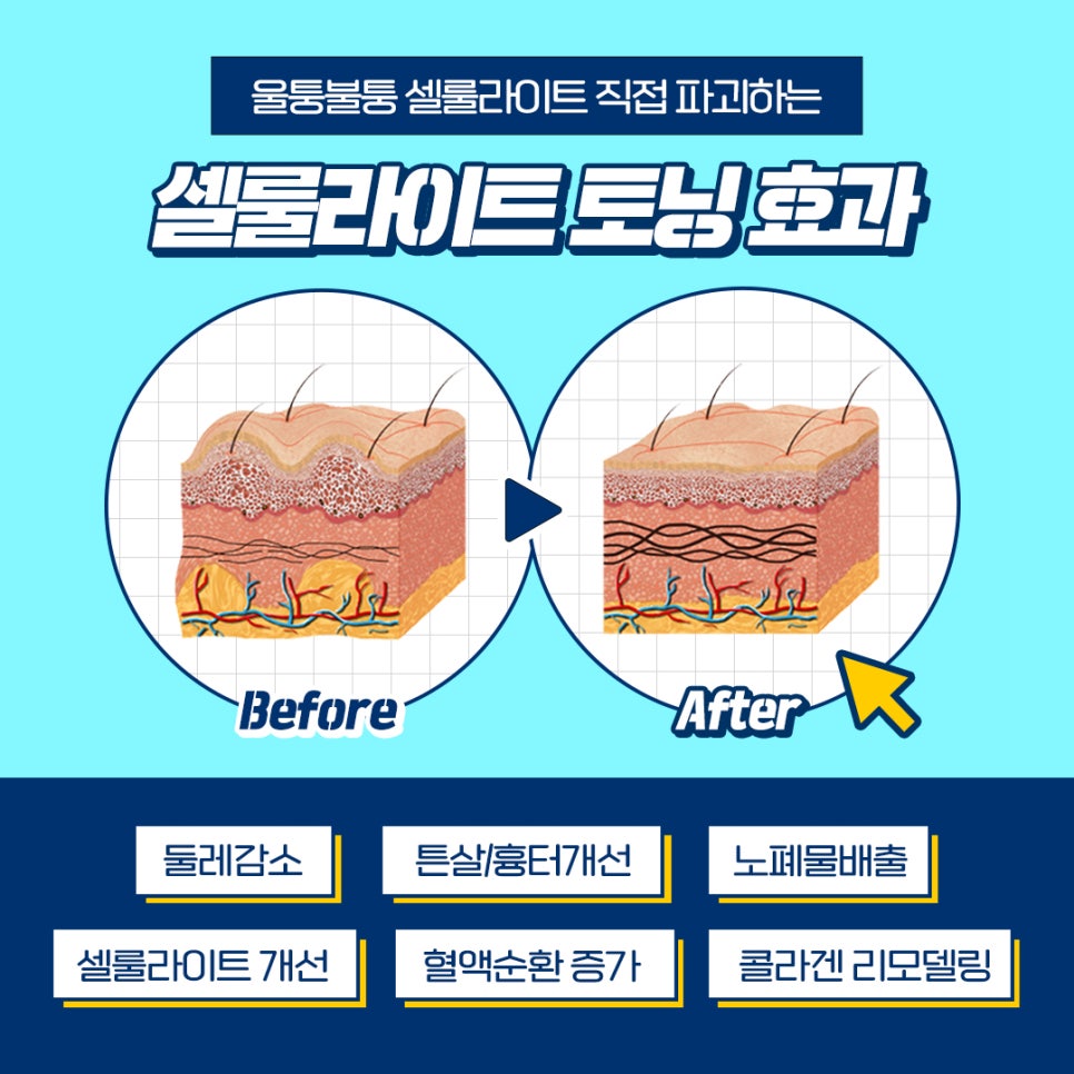 어느계절이나 날씬하고 예쁜다리만드는 방법 관련 이미지 11