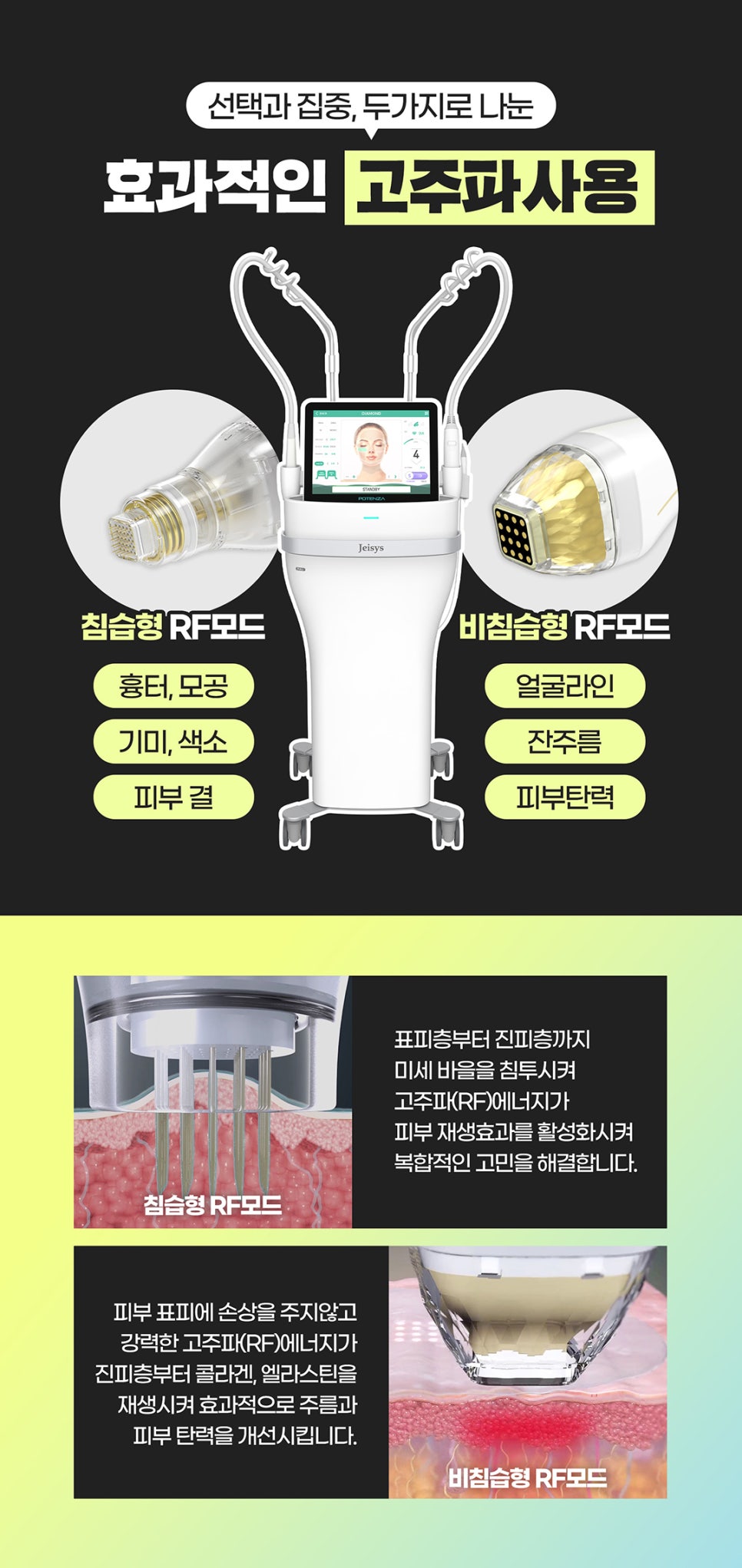 처진볼살리프팅은 피부탄력 조합 포텐슈링크로! 관련 이미지 5