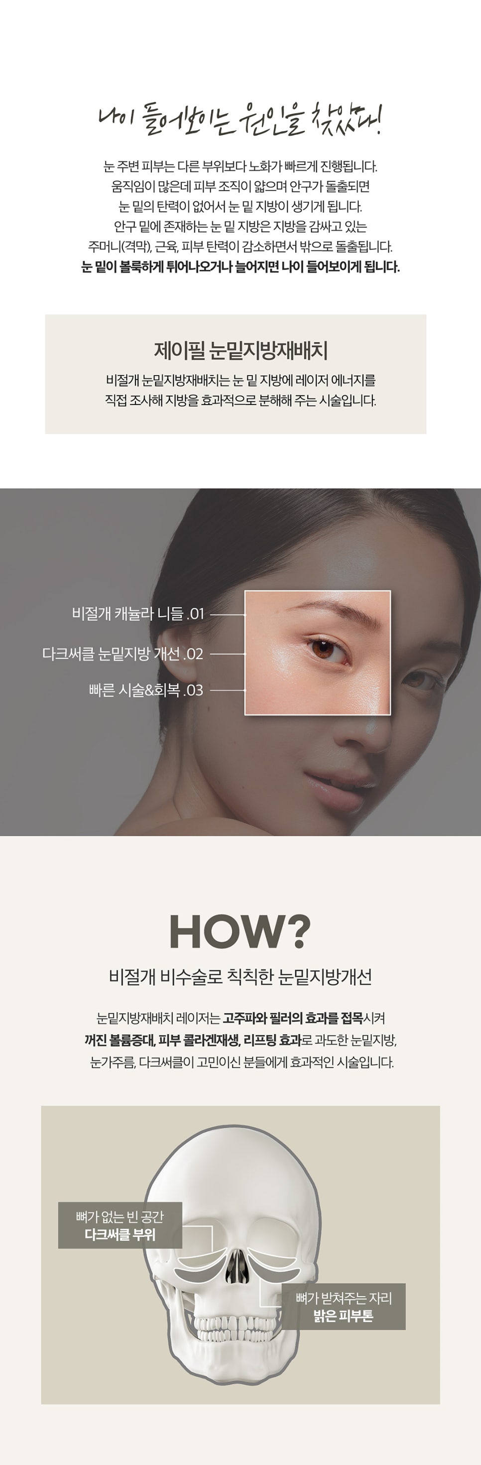 눈밑지방제거방법을 찾는다면? 비수술 비절개로! 관련 이미지 2
