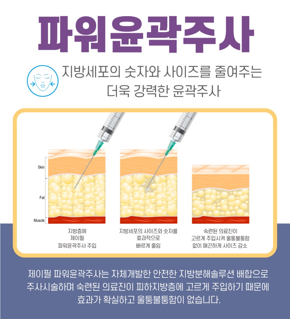 [홍대피부과] 이중턱순삭패키지로 이중턱을 지우자! 관련 이미지 5