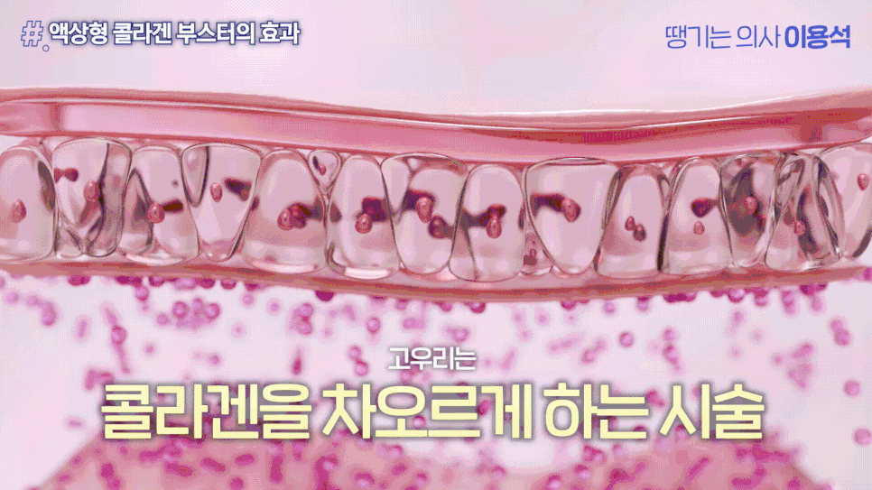 30대 40대 피부관리 추천|고우리·써마지·줄기세포 시술 TOP3 관련 이미지 7