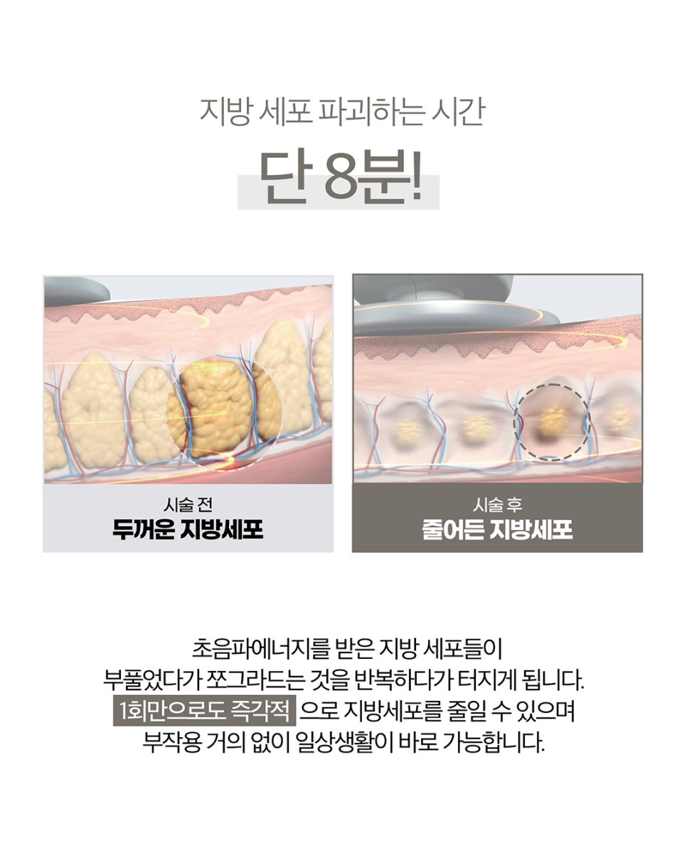 V라인만들기는 확실하게 튠인모드로 관련 이미지 5