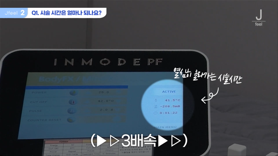 인모드와 튠페이스&튠라이너 차이점 관련 이미지 7