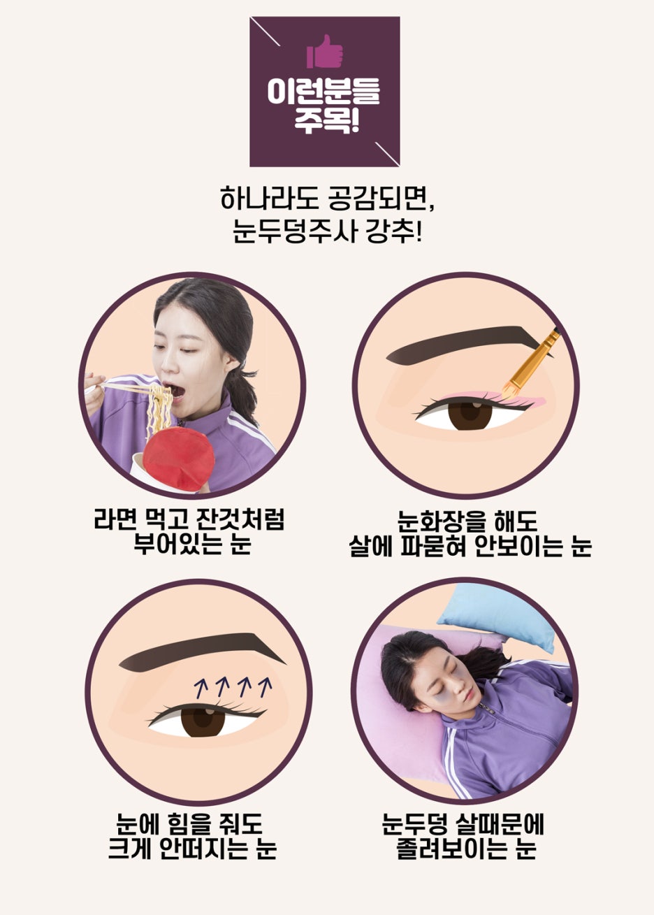 &ldquo;뚜렷한 눈&rdquo; 수술없이 주사로 1분이면 OK 눈두덩이 주사 관련 이미지 1