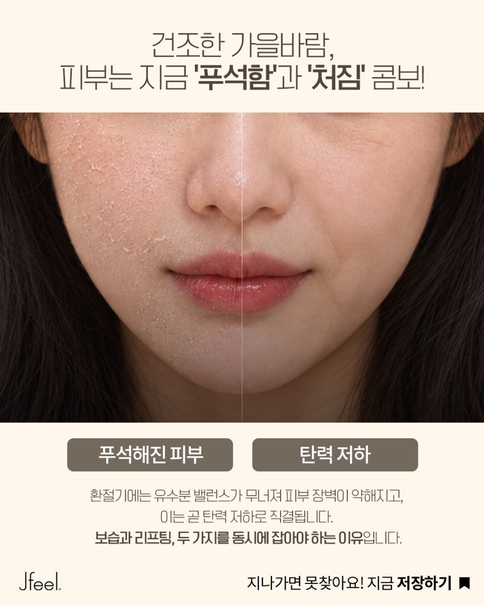 환절기 피부관리, 리쥬란만으로 부족하다면? 울쎄라 리프팅과 함께하는 가을 피부 탄력 관리 관련 이미지 5