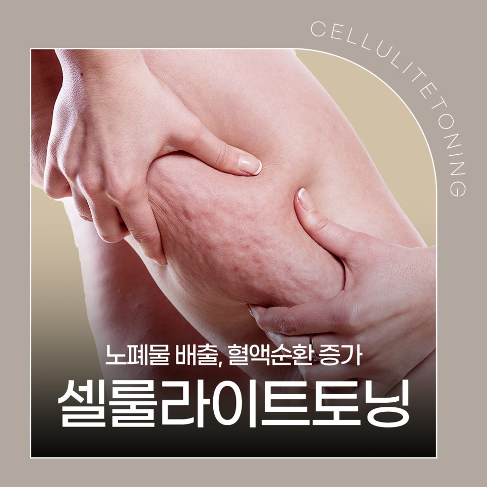 셀룰라이트토닝으로 피부 탄력 증가 관련 이미지 1