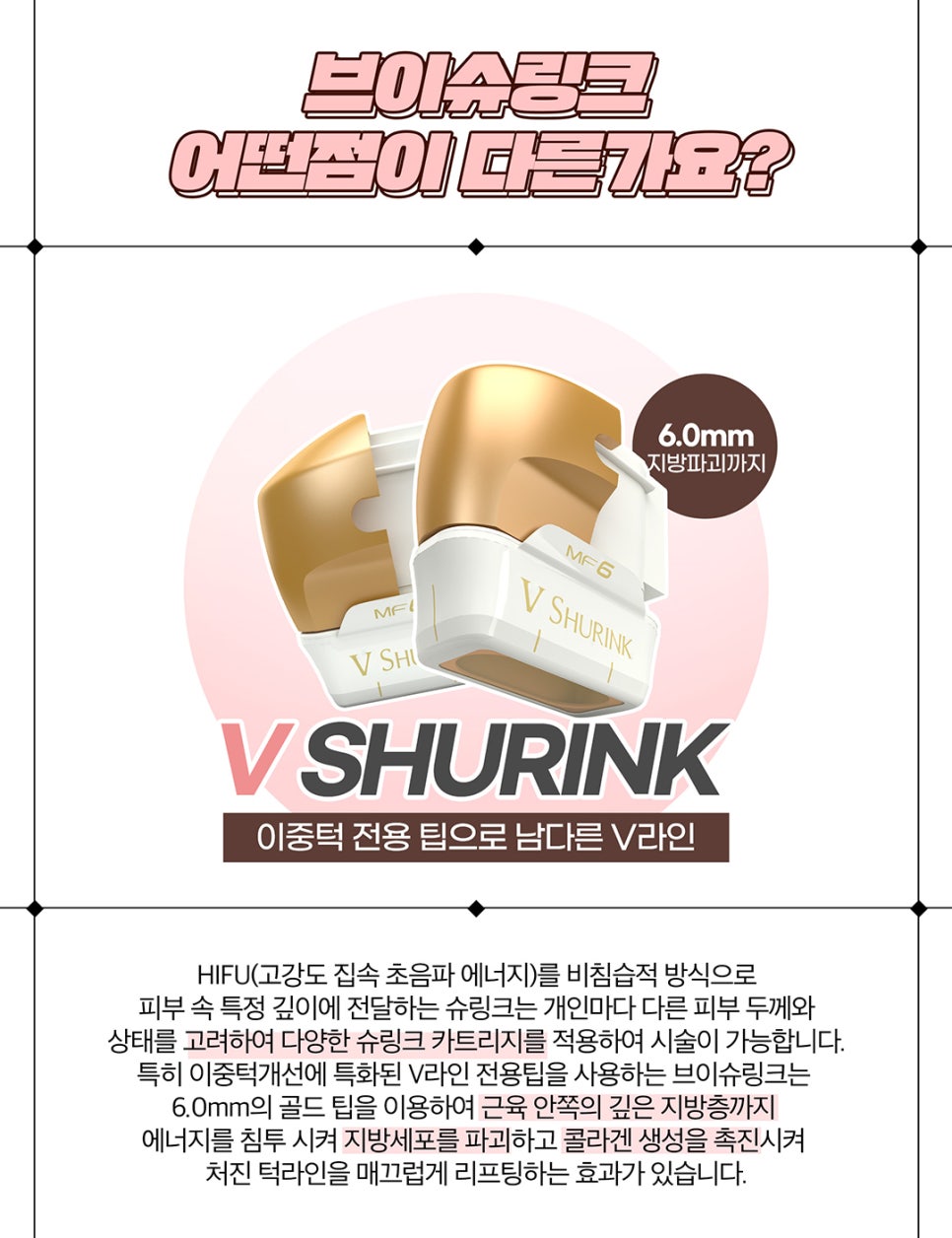 턱슈링크, 브이라인 조각 리프팅 관련 이미지 4