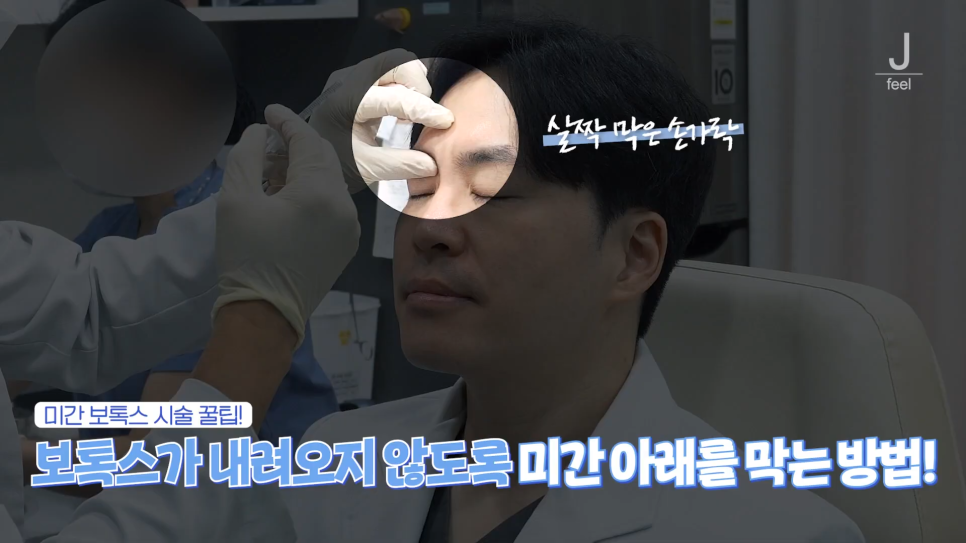 보톡스부작용 줄이는 방법, 깊은 미간과 입꼬리보톡스 관련 이미지 6