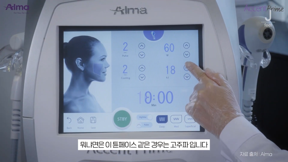 인모드와 튠페이스&튠라이너 차이점 관련 이미지 2