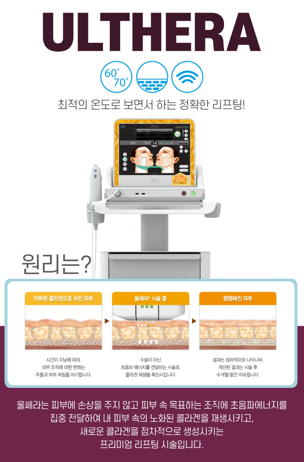 홍대울쎄라 잘하는곳. 슈링크도 역시 제이필의원 관련 이미지 3
