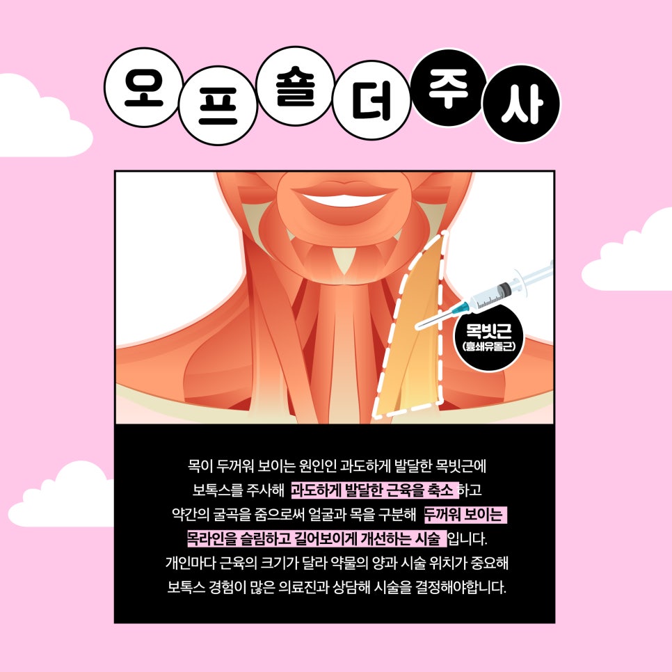 두꺼운 목, 승모근때문에 오픈숄더옷 입기 부담스러웠다면? 관련 이미지 3