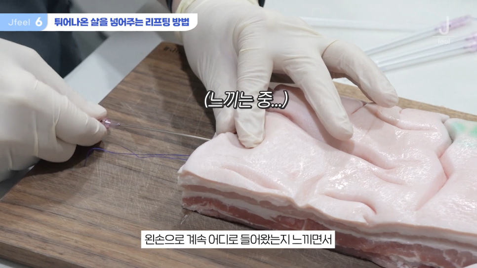 민트실을 돼지고기에 넣는다면? 실리프팅 실험 관련 이미지 17