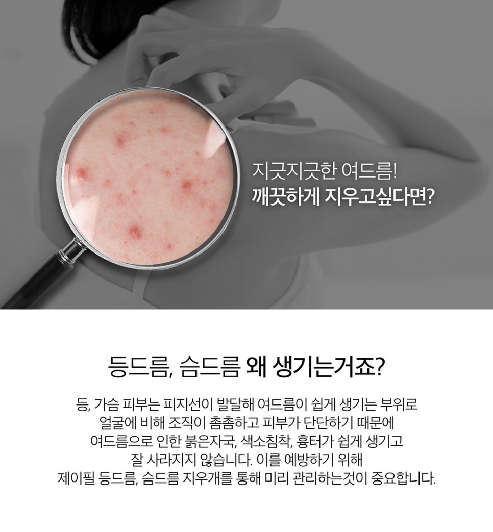 등드름제거는 알리딘필링으로 확실하게! 관련 이미지 2