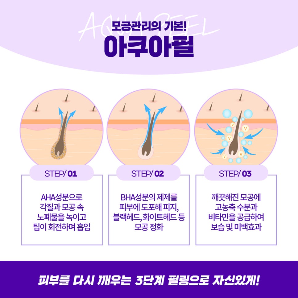 블랙헤드, 모공관리엔 촉촉한 아쿠아필로 효과보세요 관련 이미지 3