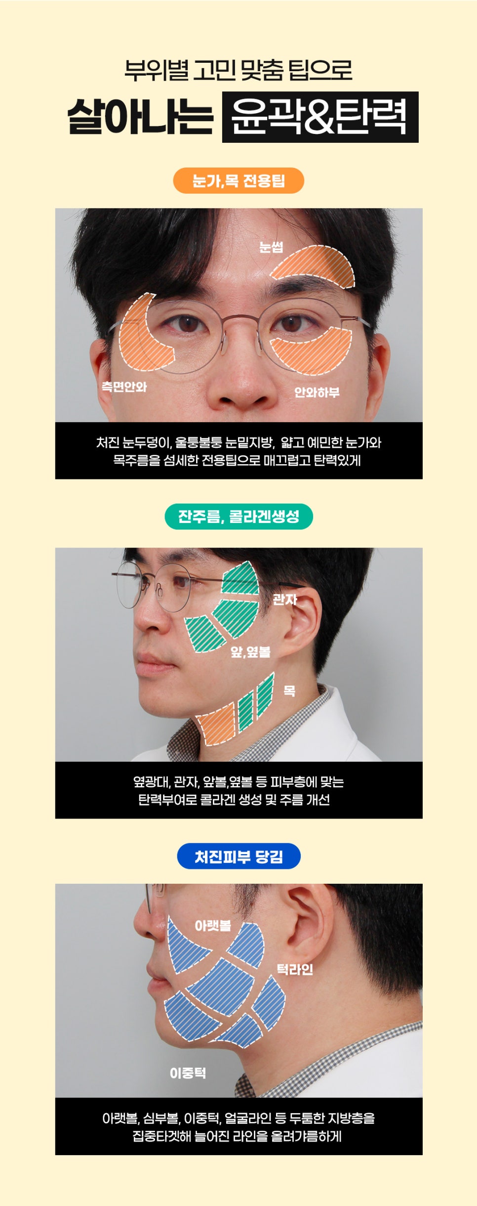 홍대피부과 얼굴주름리프팅 만족스러운 효과 관련 이미지 5