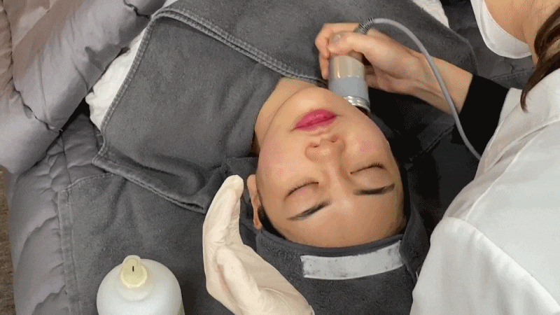 이중턱 지방 흡입, 윤곽 주사 만으로 부족 할 때는 어떤 것이 좋을까요? 관련 이미지 5