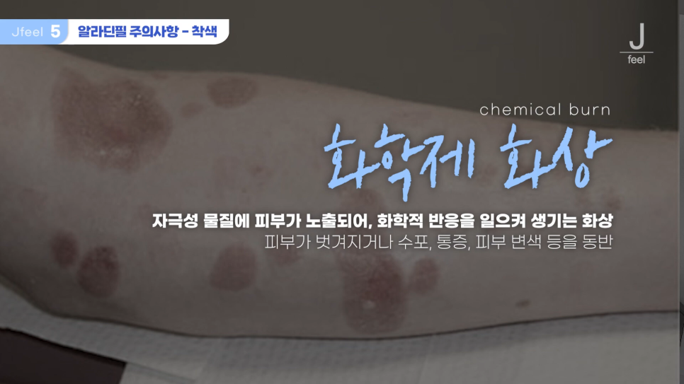 등여드름필링으로 연예인 등 만들기 관련 이미지 22