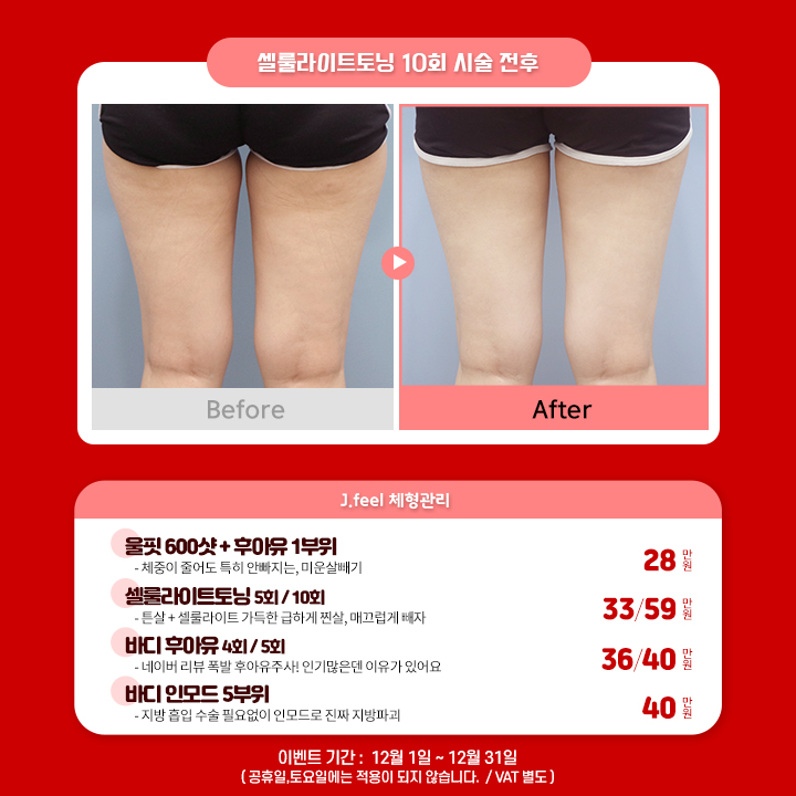 예뻐지는 홍대피부과 타임이벤트 12월의 해피아워 관련 이미지 4