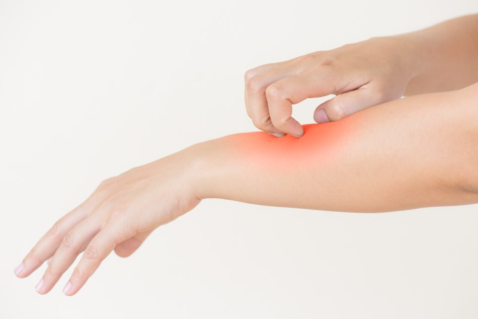 Post-Removal Care for Moles, Thread Lifting, and Fillers | Proper Use of DuoDerm image 8